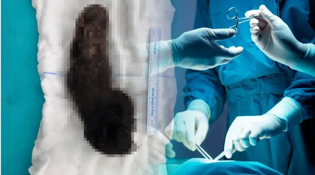 Haberler HABER Sağlık 15 yaşındaki çocuğun midesinden çıkanlar doktorları şaşkına çevirdi